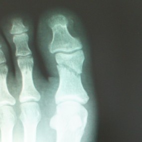 大家都别学我，我活该的！